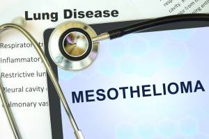 Mesothelioma and Asbestos