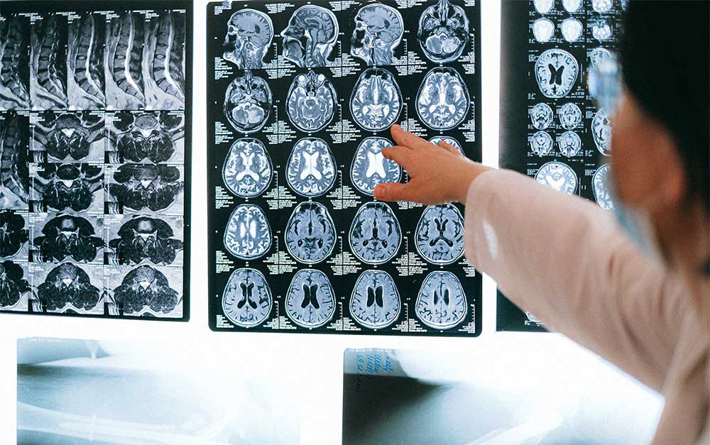 Chicago Spinal Cord Injury Lawyers