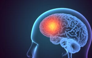 chicago brain injury attorney