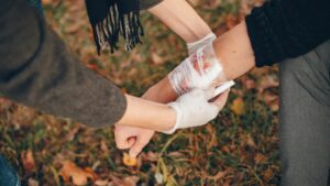 Chicago Burn Injury Lawyer