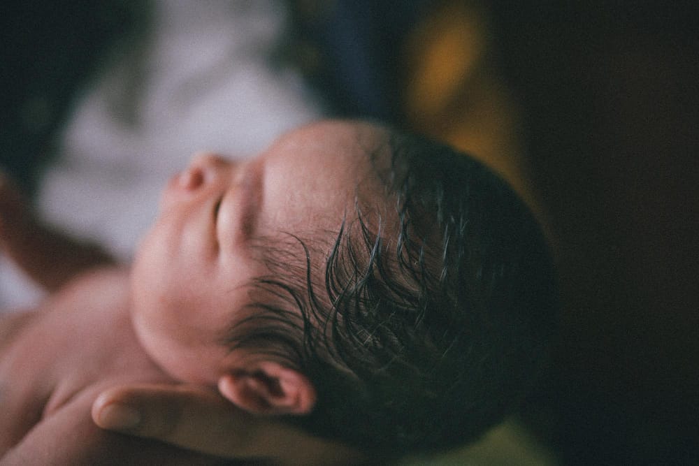 Caput Succedaneum and Cephalohematoma