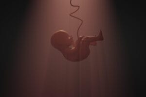 showing umbilical cord compression
