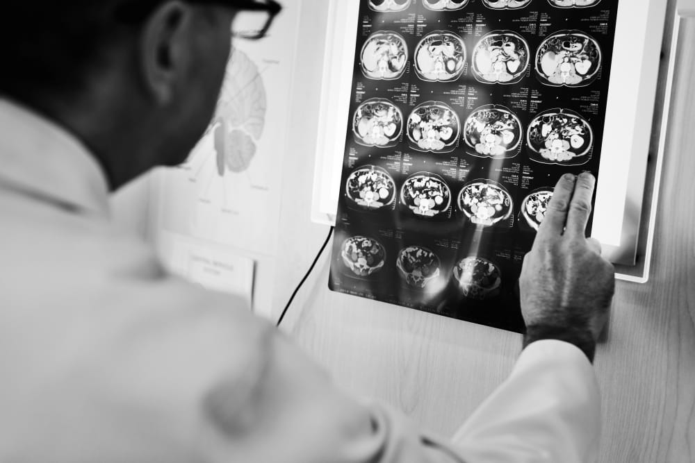 Diffuse Axonal Brain Injuries In Car Accident