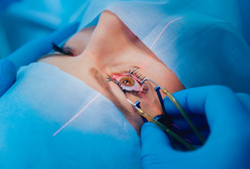 Eye Surgery lasik