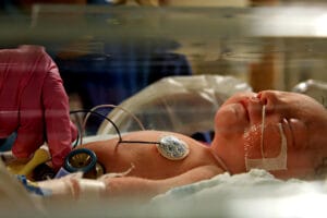 Pitocin Birth Injuries