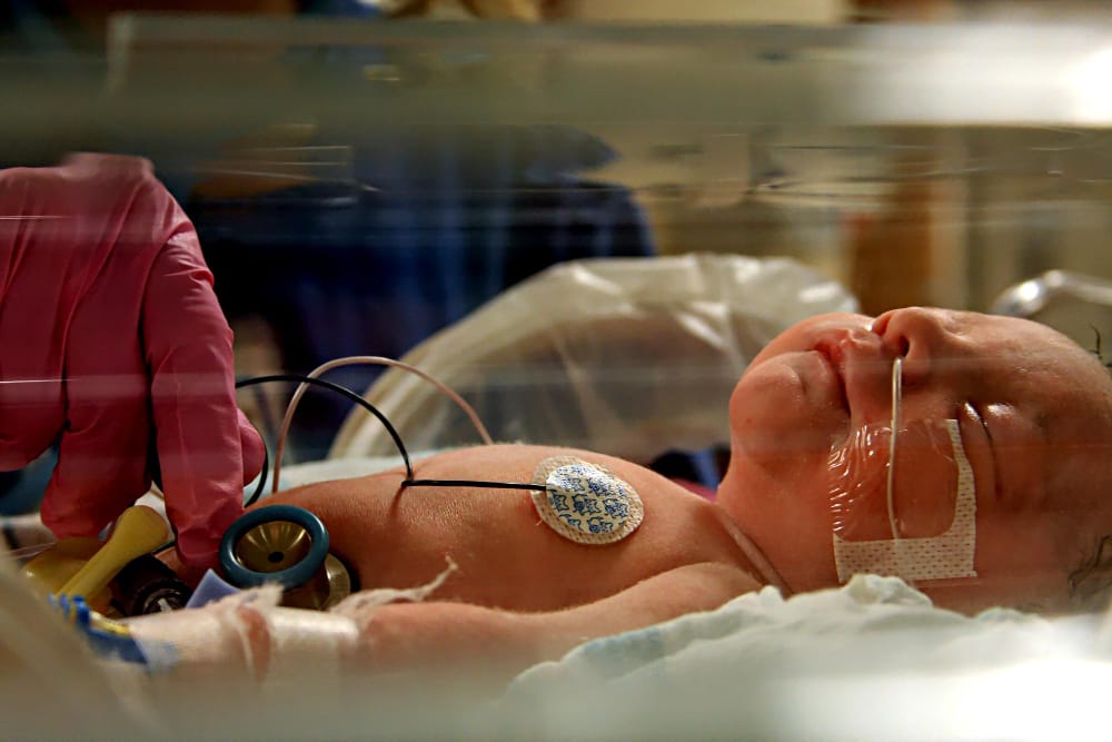 Pitocin Birth Injuries
