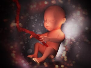 Abnormal Cord Insertion