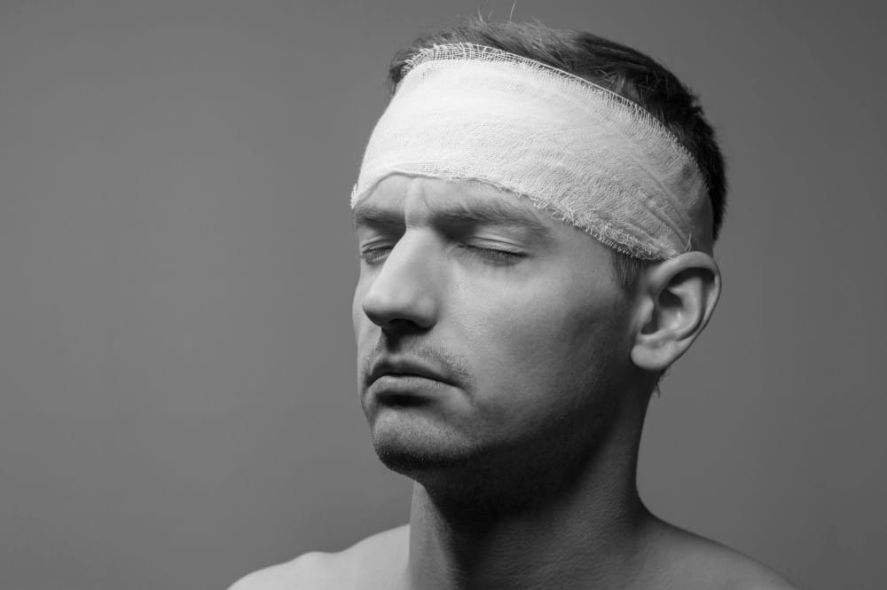 Showing an individual with visible bruising and swelling on the forehead, indicative of blunt force head trauma, highlighting the physical effects of injury.