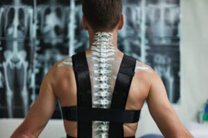 Hangman’s Fracture