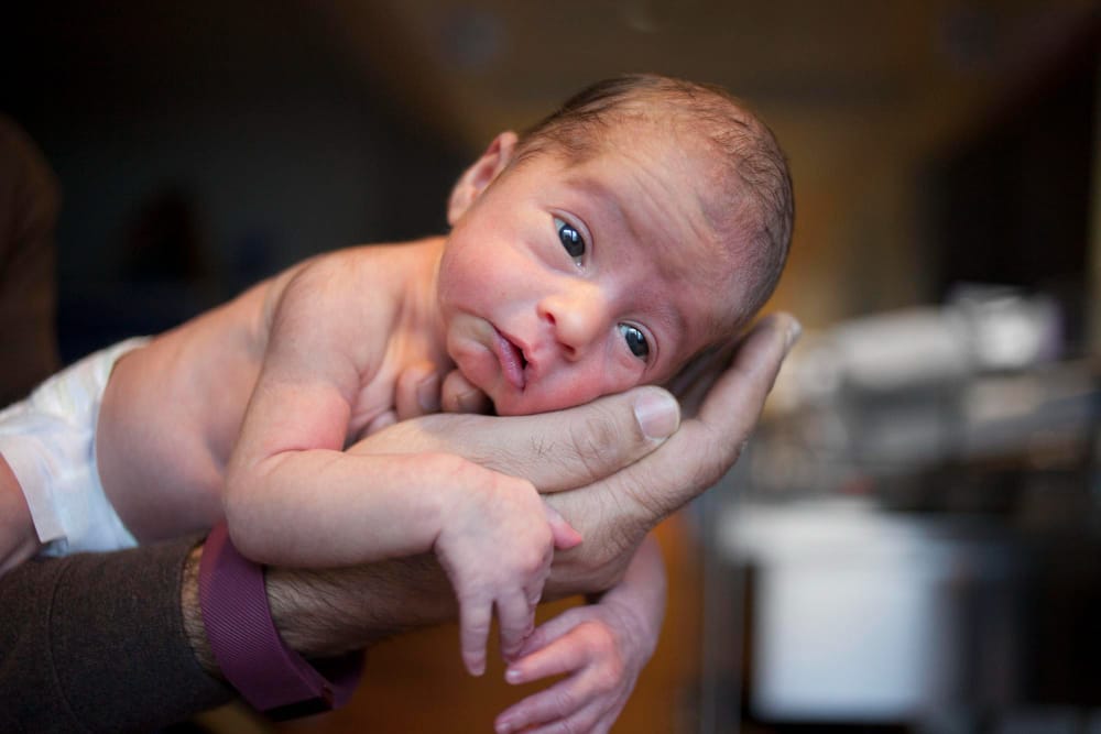 Zofran Birth Injury Lawsuits