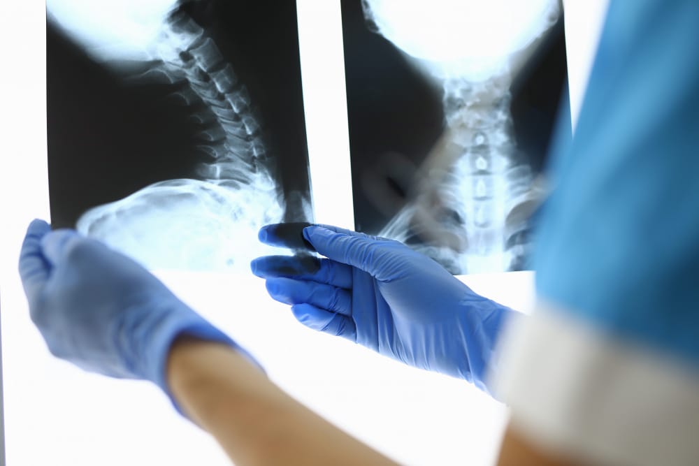 Paraplegia Injury