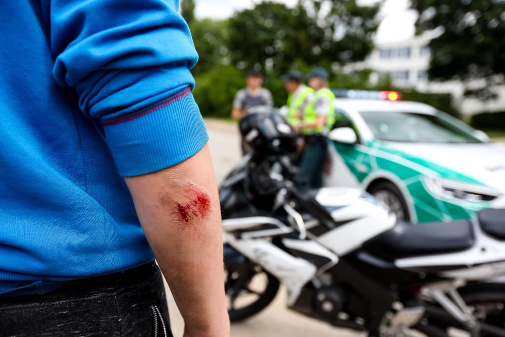 Muscle Damage From Motorcycle Accidents In Chicago