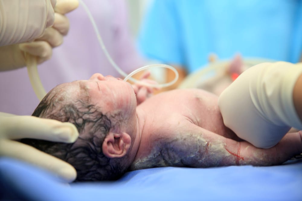 Champaign birth injury lawyer