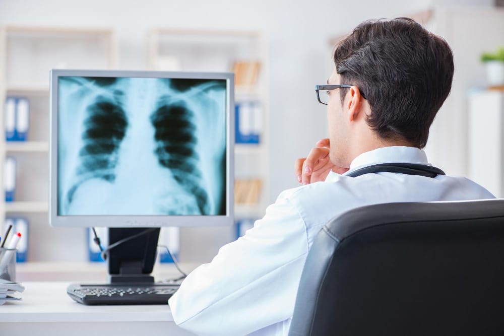Lung Damage Due to Vaping in Chicago