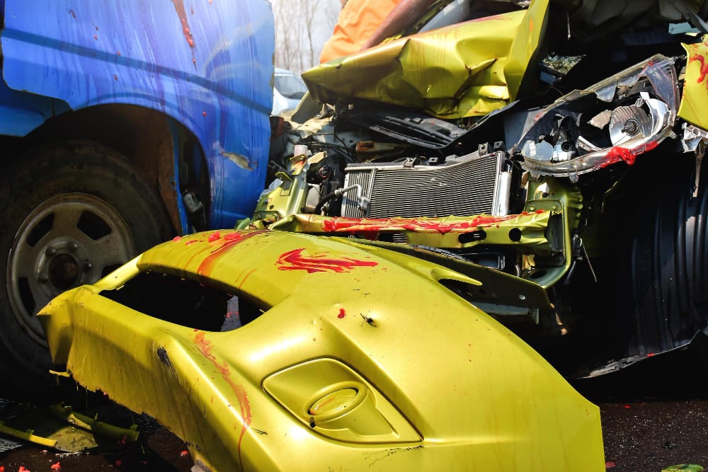 What Must You Prove in an Automobile Accident Case?