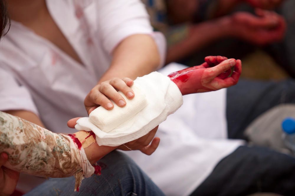 Do I Need a Lawyer for Burn Injury Claims
