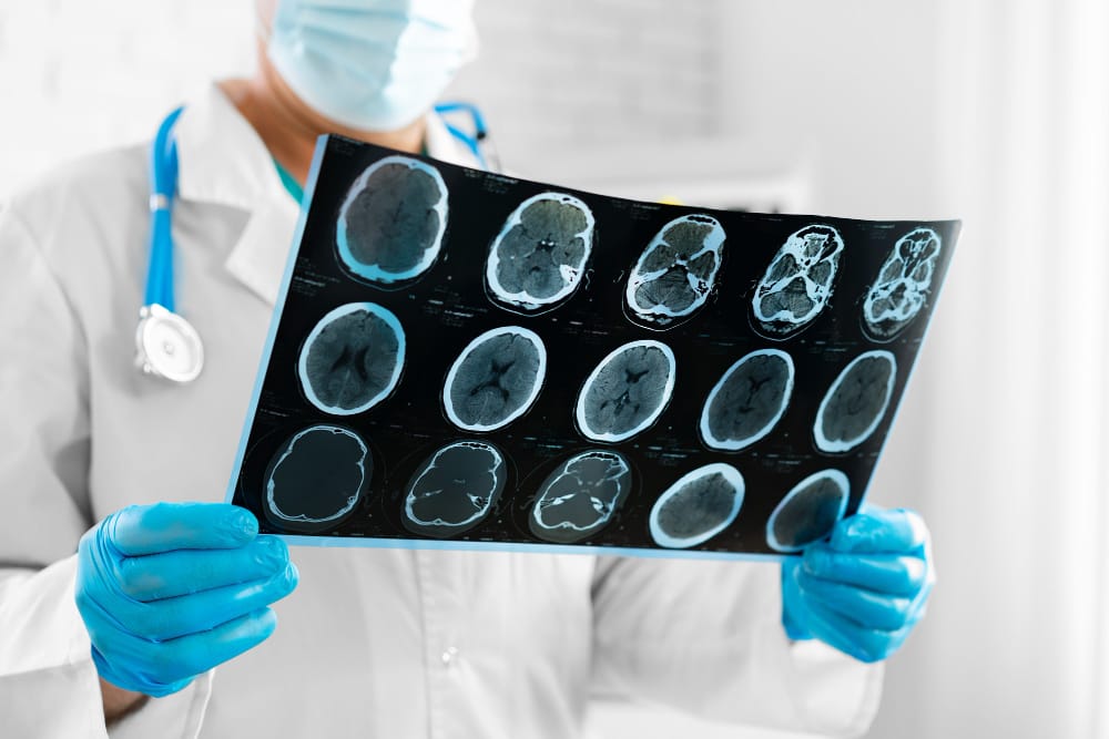 Can You Recover from a Traumatic Brain Injury