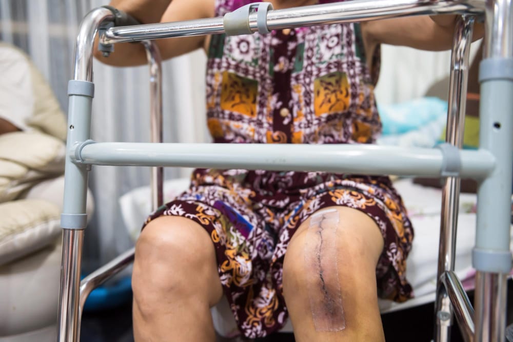 Fall Injuries in Nursing Homes