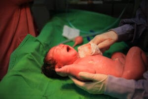 What to Do if You Suspect Your Child Has a Birth Injury