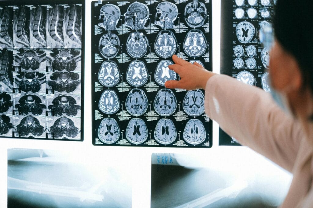 Radiologist examining brain MRI scans to diagnose childhood brain injury
